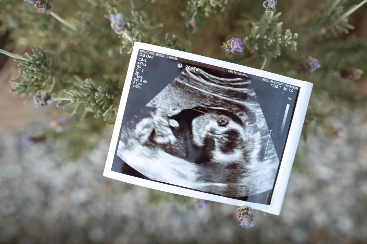Les 4 meilleurs fœtus Doppler à domicile pour écouter le cœur de votre bébé