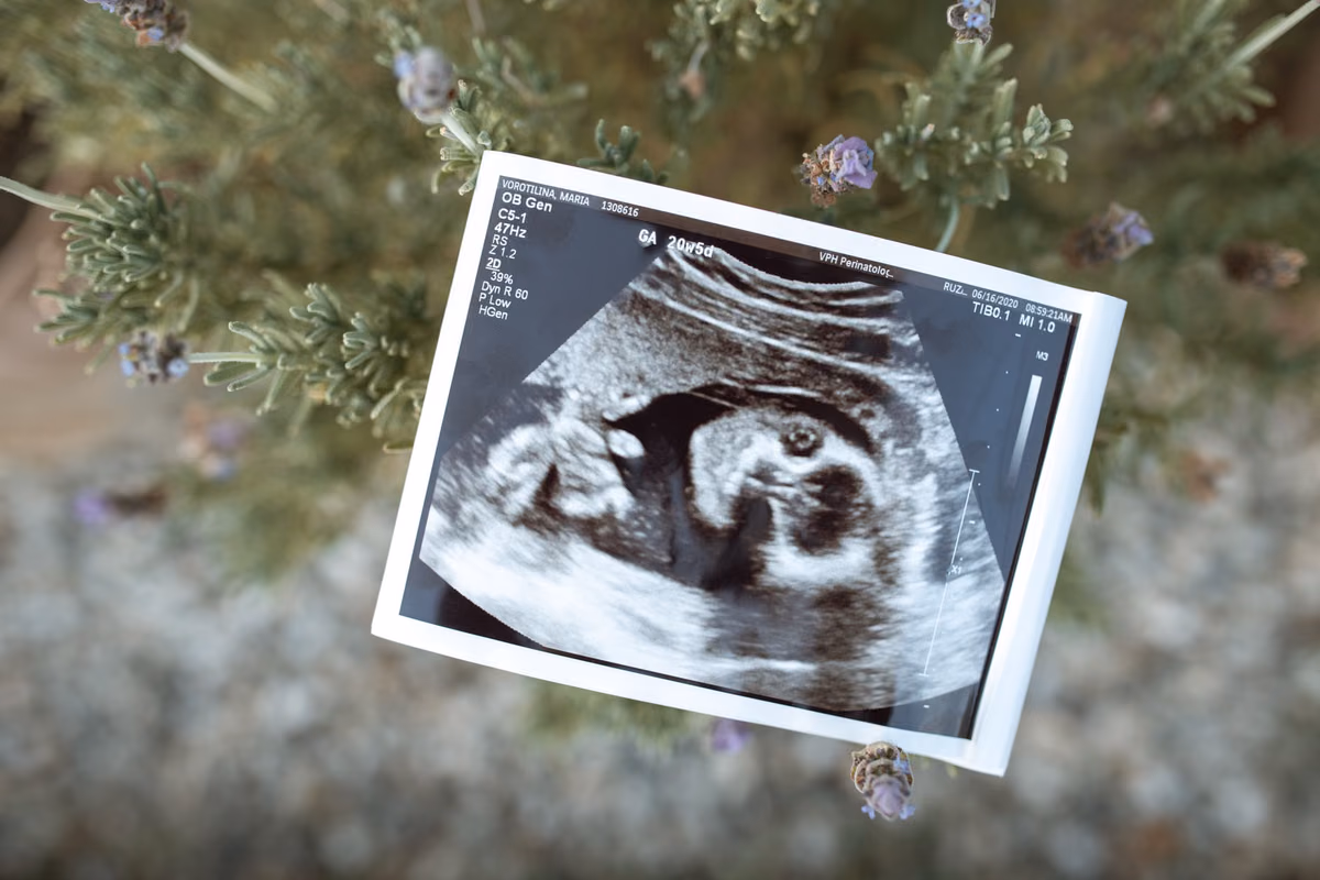 Les 4 meilleurs fœtus Doppler à domicile pour écouter le cœur de votre bébé